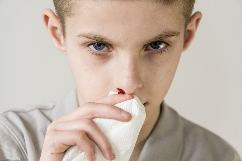 鼻子反复出血预示着白血病吗？