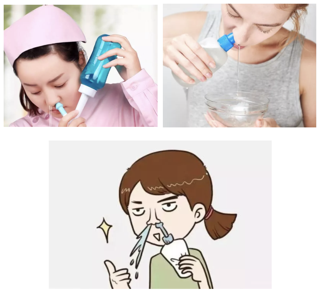 「洗鼻法」对过敏性鼻炎很有效？这些知识点帮你全面预防